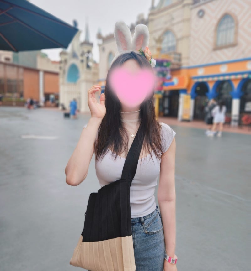 모티바 1년 4개월 차 후기_넥스트성형외과 사진 3