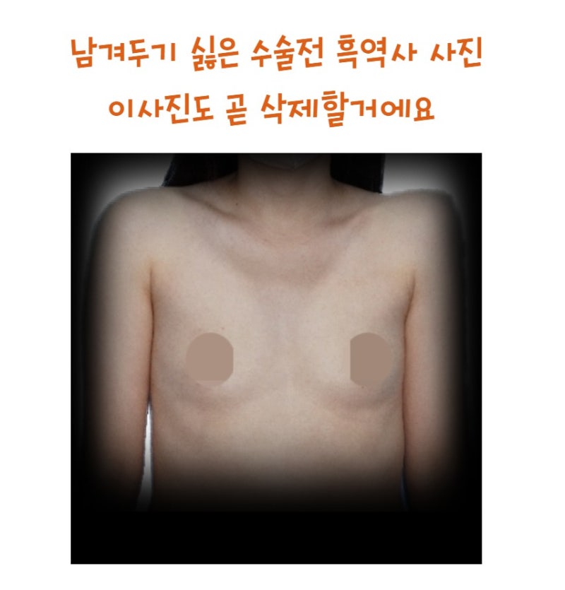 모티바 340cc 한 달 후기 사진 2