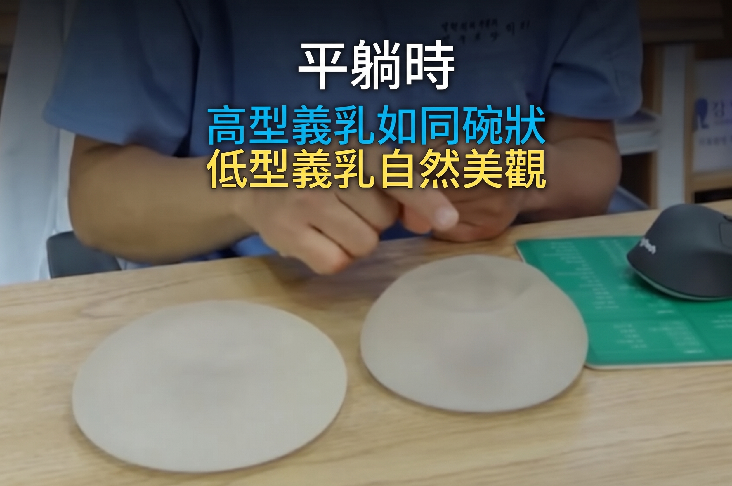 決定植入物隆乳手術時的兩大關鍵？ 사진 8